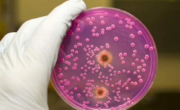 Phân lập, tuyển chọn và định danh vi khuẩn dạ cỏ của bò để phân giải bột bã mía