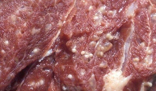 Bệnh gạo lợn: Những điều cần biết